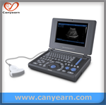 PC based 3D option laptop medical imaging system/Ultrasound scanner/Machine/Sonography